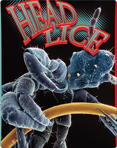 Head Lice