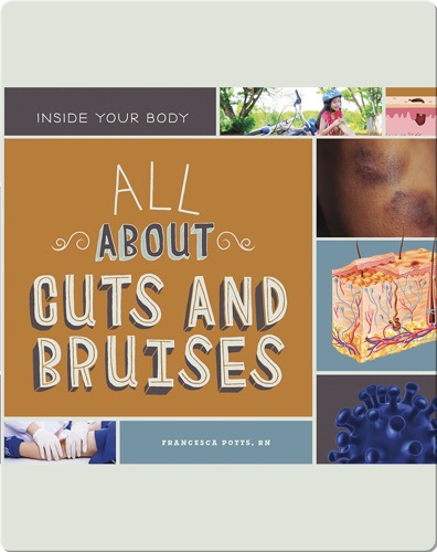 All About Cuts and Bruises